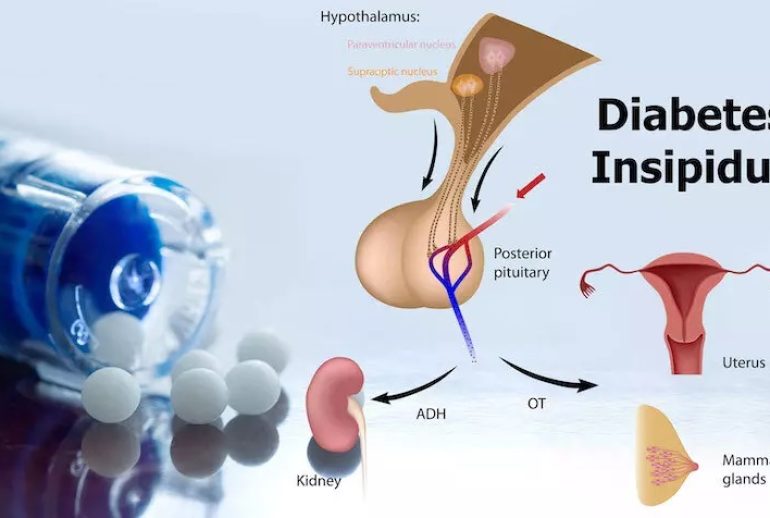 دیابت بی مزه