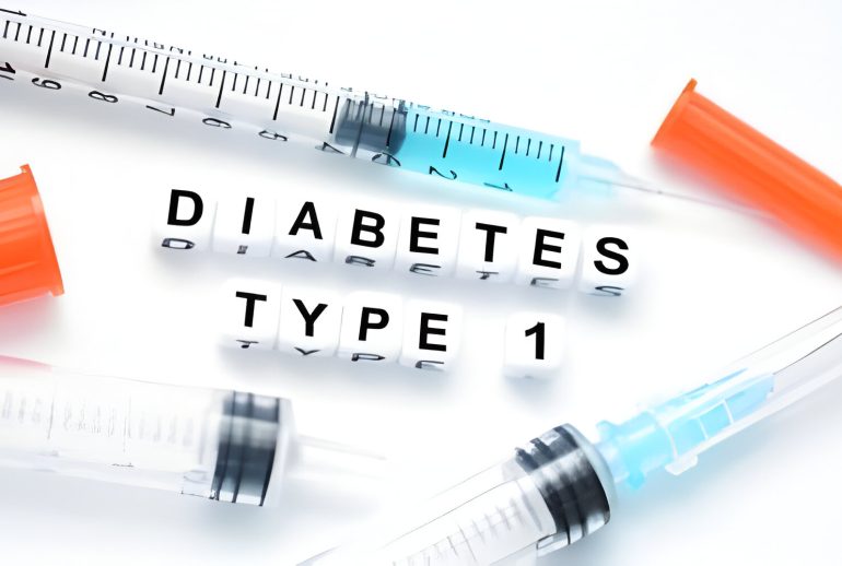 دیابت نوع یک