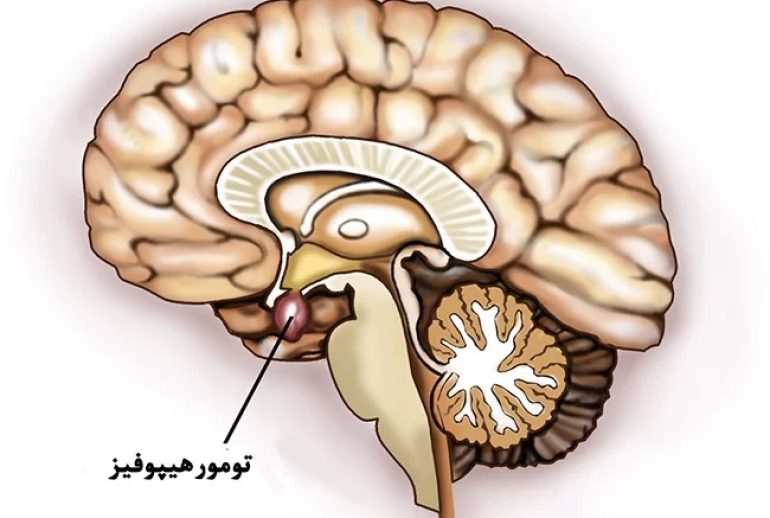 هیپوفیز
